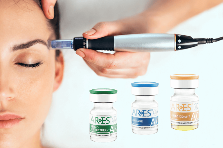 Mezoterapie Ares & Microneedling - pachet cu plata în rate lunare, Lagoon București