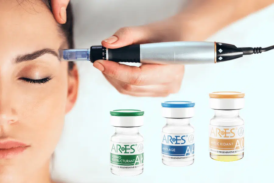 Mezoterapie Ares & Microneedling