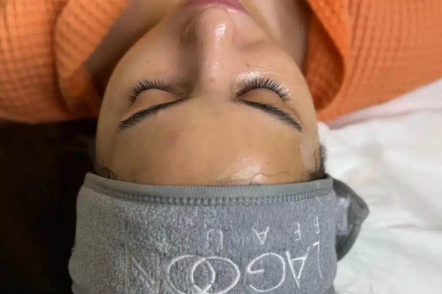 Peeling Cavitational cu Ultrasunete - imagine 4