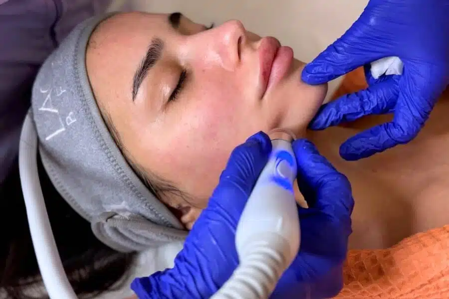 Peeling Cavitational cu Ultrasunete - imagine 2