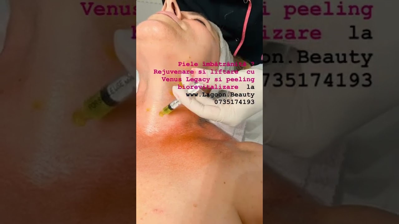 Redă videoul
