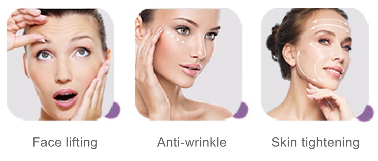 Direcțiile de tratament HIFU pentru lifting facial, riduri și fermitatea pielii